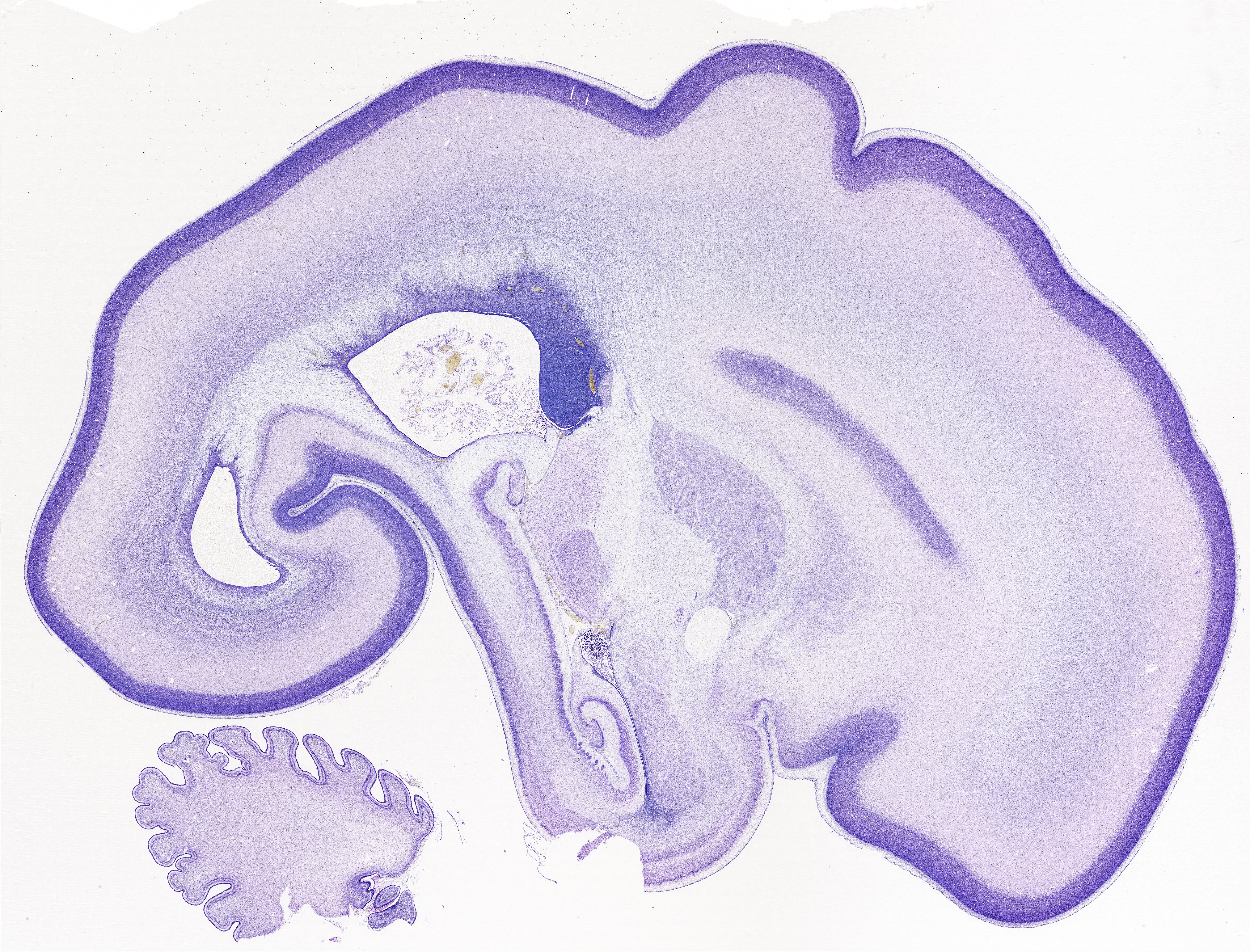 Fetal Brain Nissil Stain